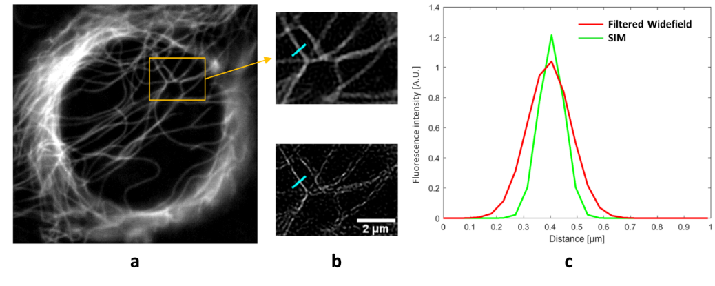 Darstellung des Zytoskeletts nach Färbung mit Tubulin TrackerTM Green mit Weitfeldmikroskopie und Structured Illumination Microsocpy, SIM 
